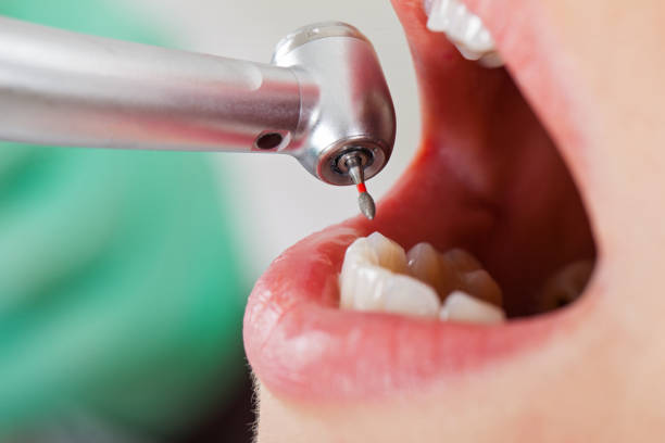 Best Same-Day Emergency Dentist in Owens Cross Roads, AL